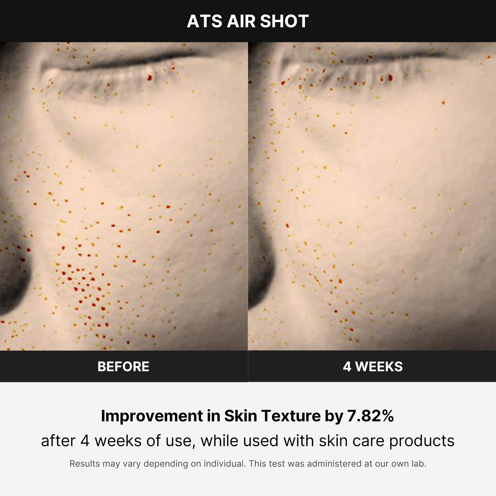 Foto 5 | Dispositivo  Medicube Age-r Ats Air Shot - Venta Internacional