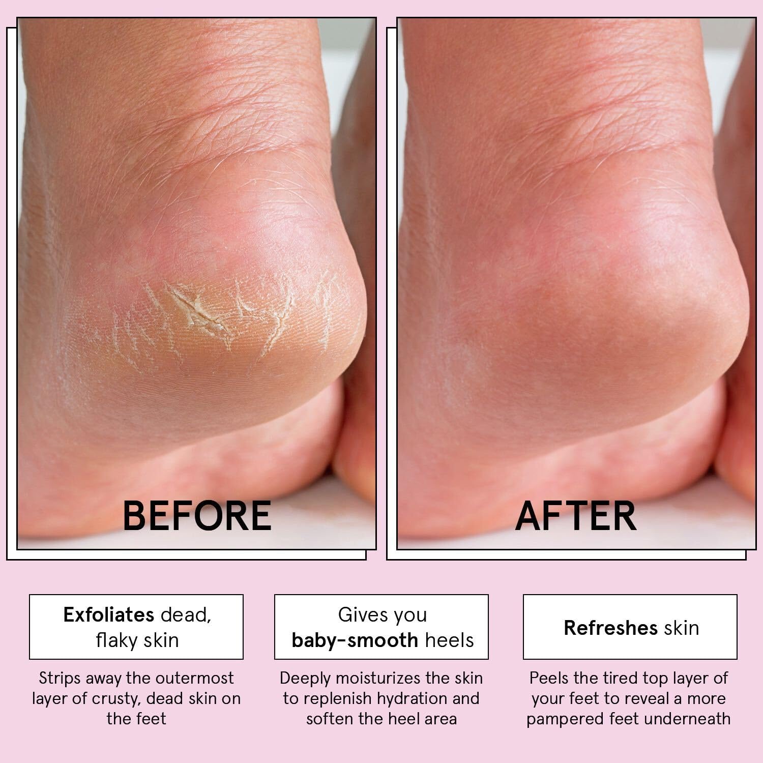Foto 4 pulgar | Mascarilla Exfoliante Para Pies Ganadora Del Premio Grace & Stella Con Aloe Vera, 4 Pares - Venta Internacional.