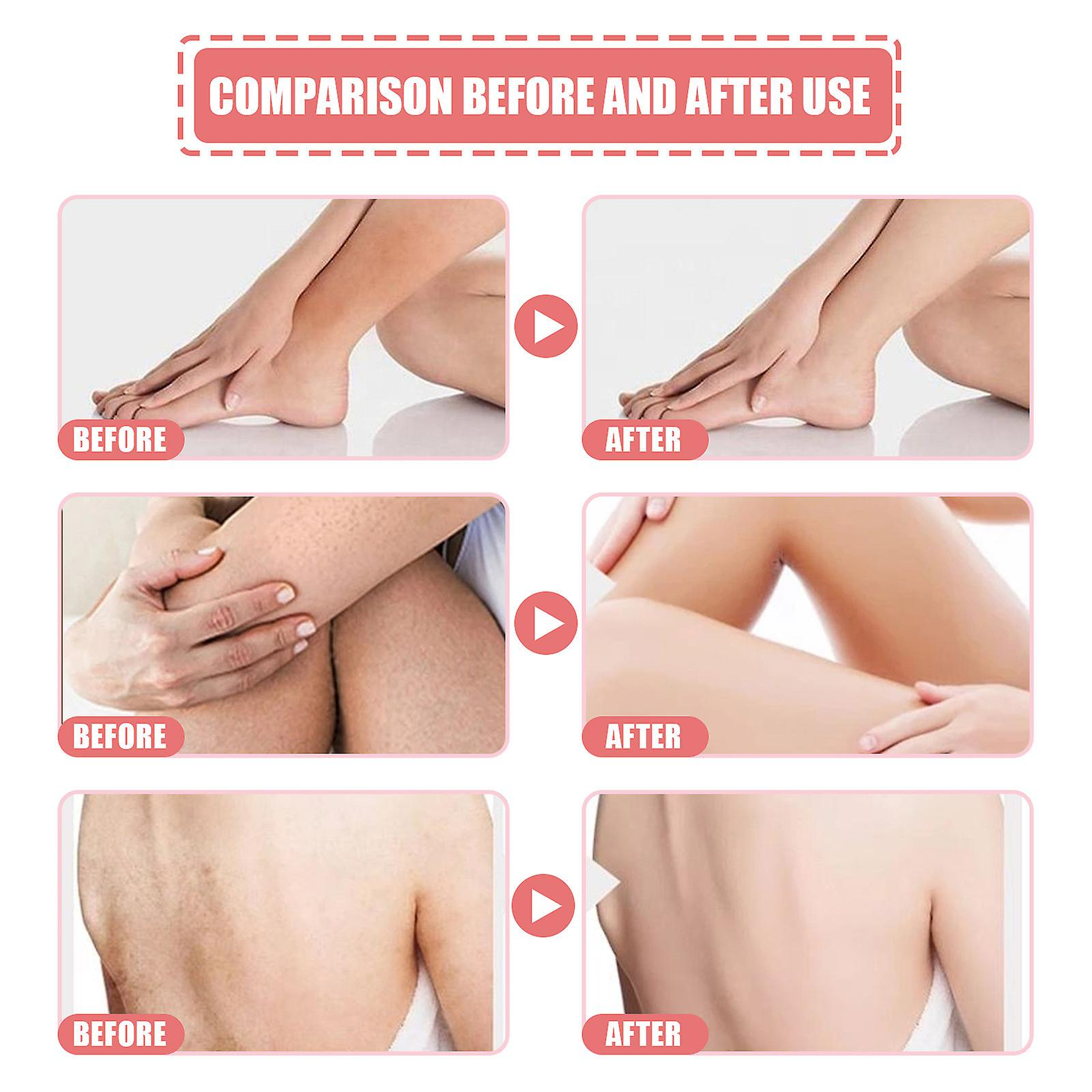 Foto 6 pulgar | Crema Exfoliante Corporal Huoguo Peach Para Limpieza Profunda Y Blanqueamiento De La Piel - Venta Internacional.