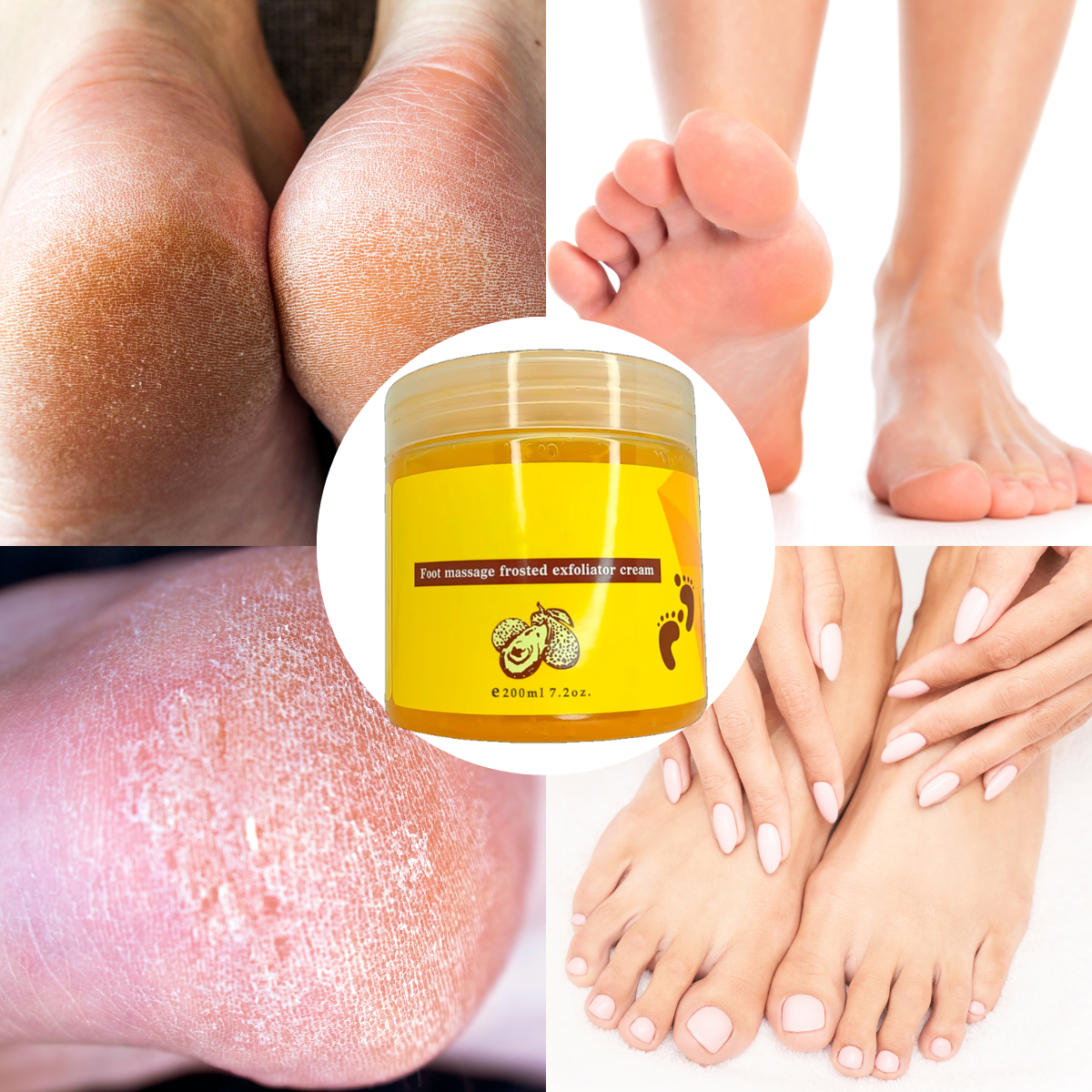 Foto 7 pulgar | Exfoliante Para Pies Rorec Elimina Callos Resequedad