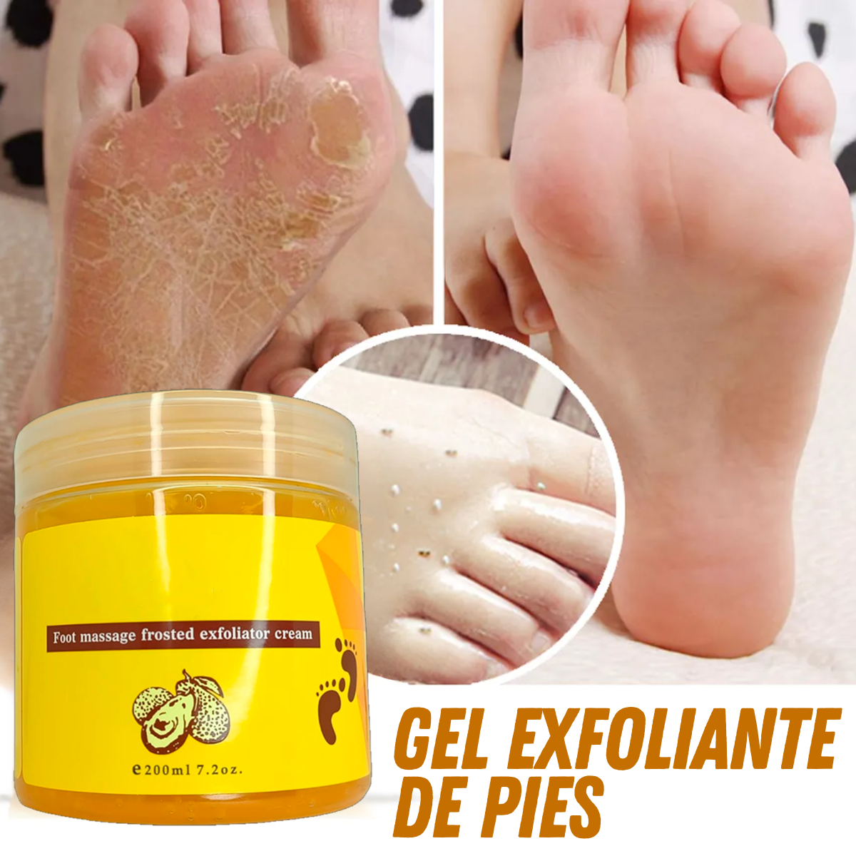 Foto 7 | Exfoliante Para Pies Rorec Elimina Callos Resequedad
