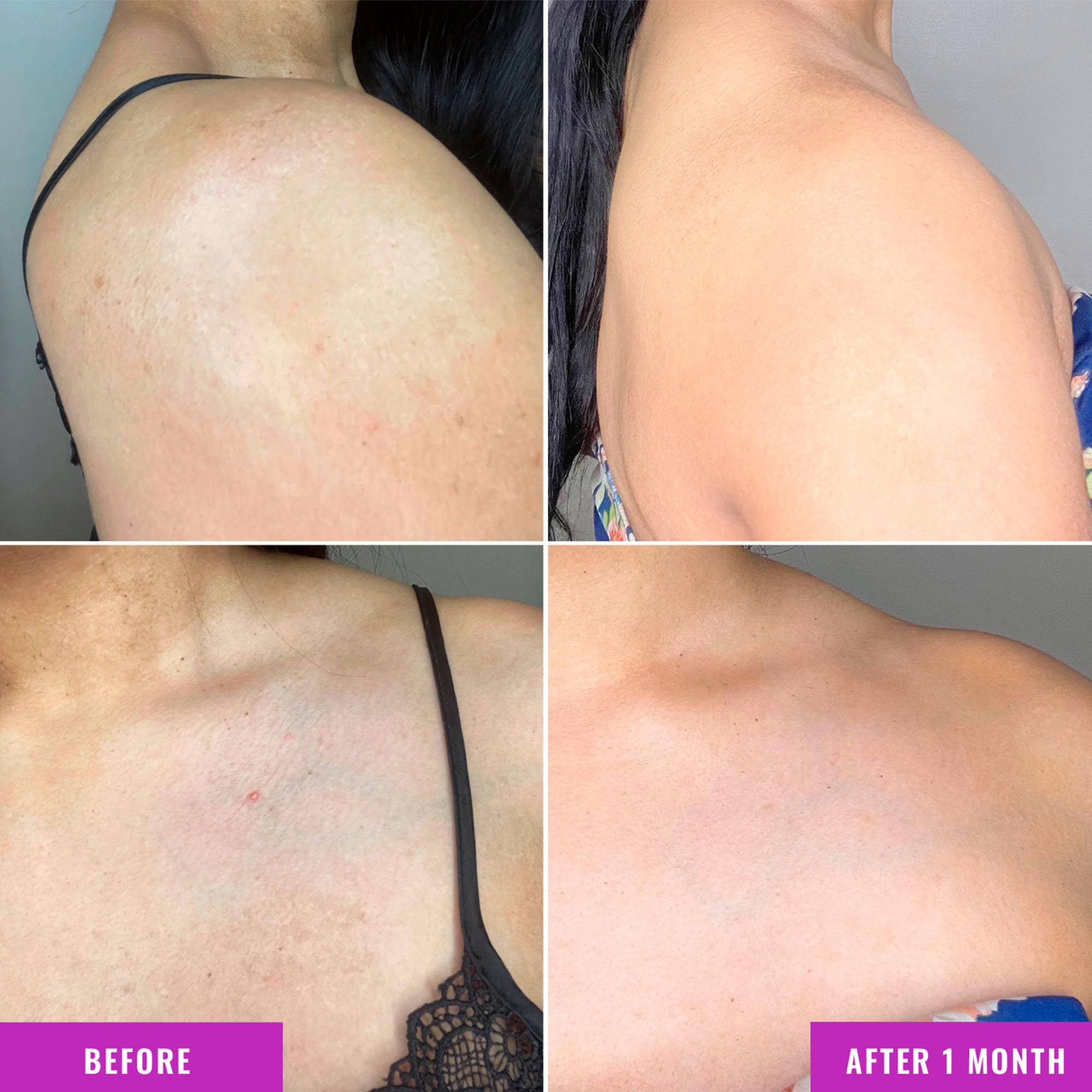 Foto 5 pulgar | Crema De Tratamiento Corporal Good Molecules Para Corregir La Decoloración - Venta Internacional.