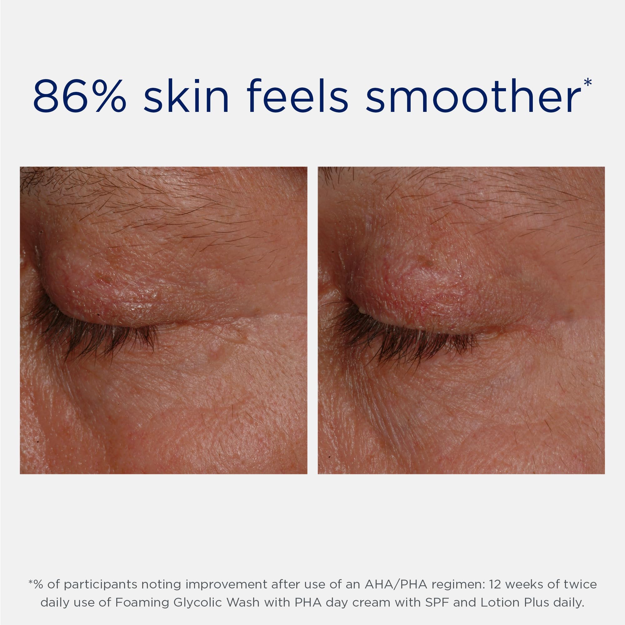 Foto 7 | Loción Neostrata Lotion Plus Advanced Aha Exfoliante 200 Ml - Venta Internacional.