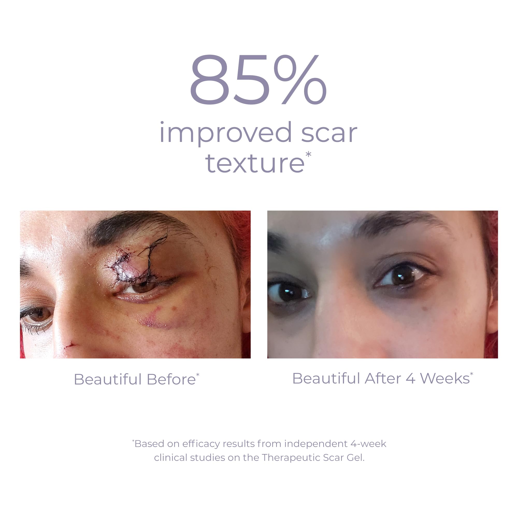 Foto 6 pulgar | Gel De Tratamiento De Cicatrices Derma E Para Rostro, 60 Ml, Con Pantenol Y Alantoína - Venta Internacional.