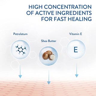 Foto 7 | Pomada Curativa Cetaphil 90 Ml Para Piel Seca, Agrietada E Irritada - Venta Internacional.