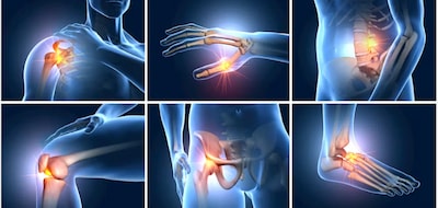 Foto 3 | Mamisan Ungüento Antinflamatorio Dolor Muscular Lesiones 200 G (3 Piezas)