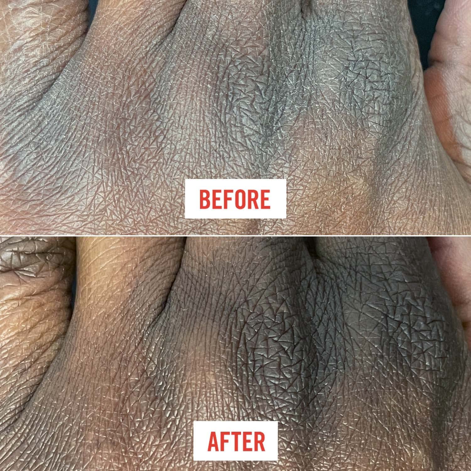 Foto 6 pulgar | Crema Hidratante First Aid Beauty Ultra Repair, 177 Ml - Venta Internacional.