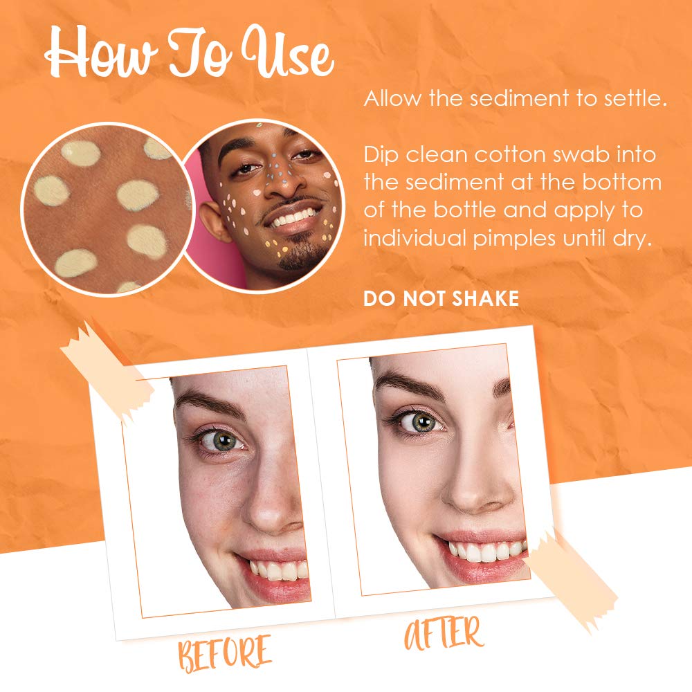 Foto 5 pulgar | Loción Bye Bye Bye Blemish Dark Spot Vitamina C 30 Ml - Venta Internacional.