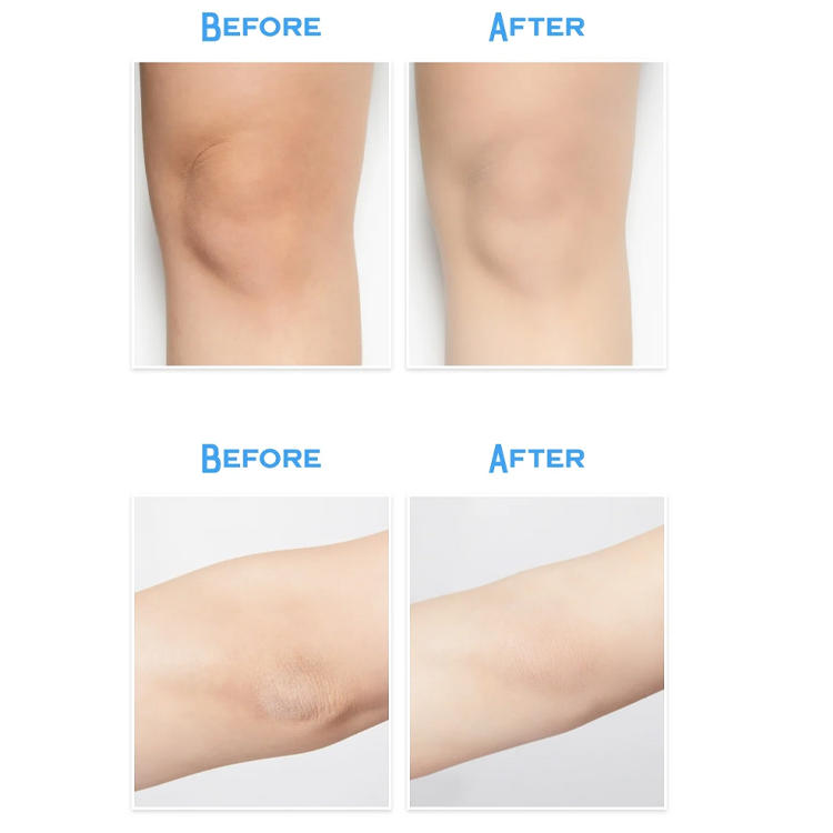 Foto 5 pulgar | Crema Corporal Aclarante Con Efecto Refrescante Tonymoly