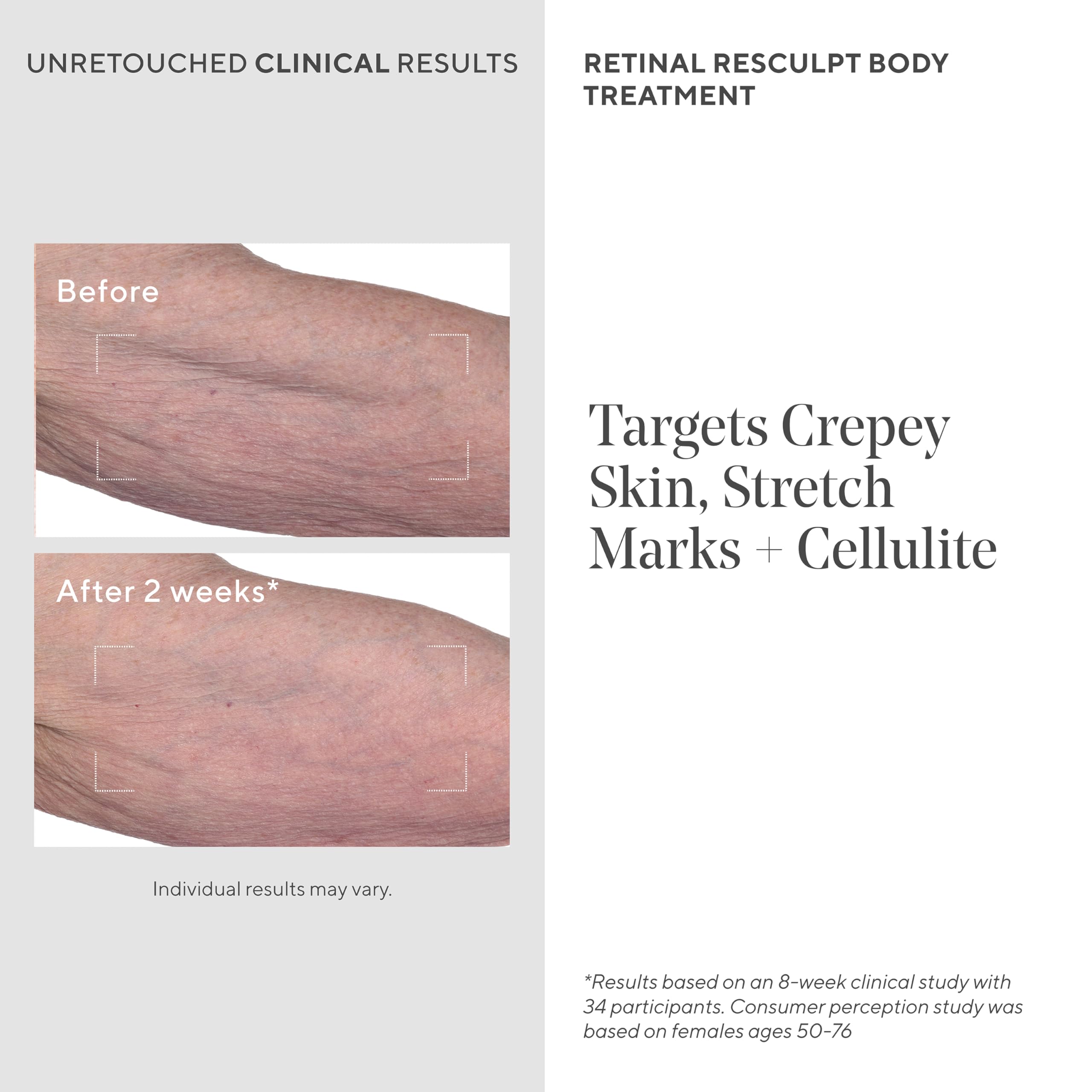 Foto 3 | Crema De Tratamiento Corporal Murad Retinal Resculpt 150 Ml - Venta Internacional.