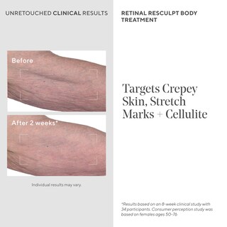 Foto 3 | Crema De Tratamiento Corporal Murad Retinal Resculpt 150 Ml - Venta Internacional.