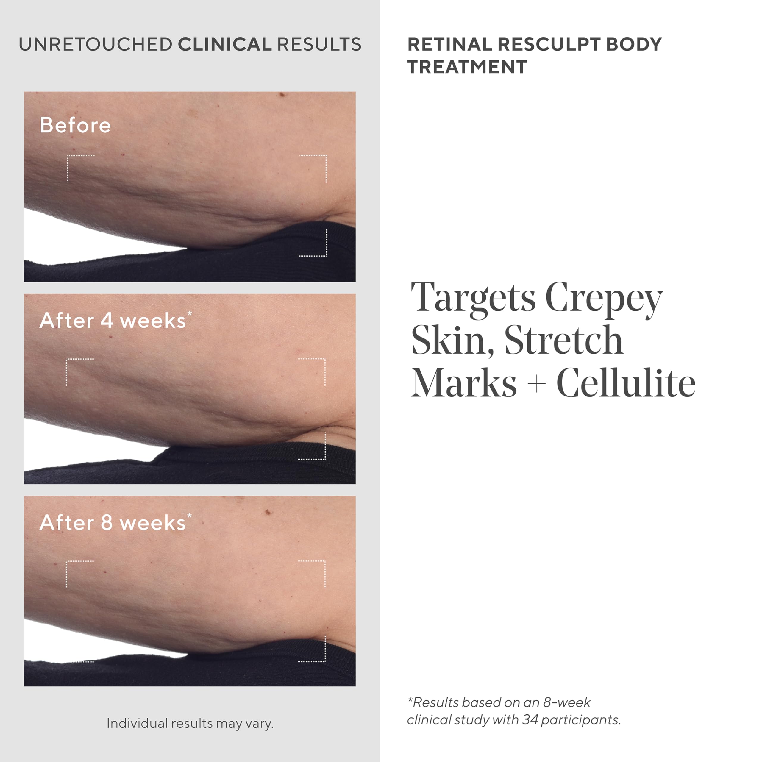 Foto 6 | Crema De Tratamiento Corporal Murad Retinal Resculpt 150 Ml - Venta Internacional.
