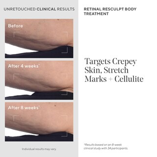 Foto 6 | Crema De Tratamiento Corporal Murad Retinal Resculpt 150 Ml - Venta Internacional.