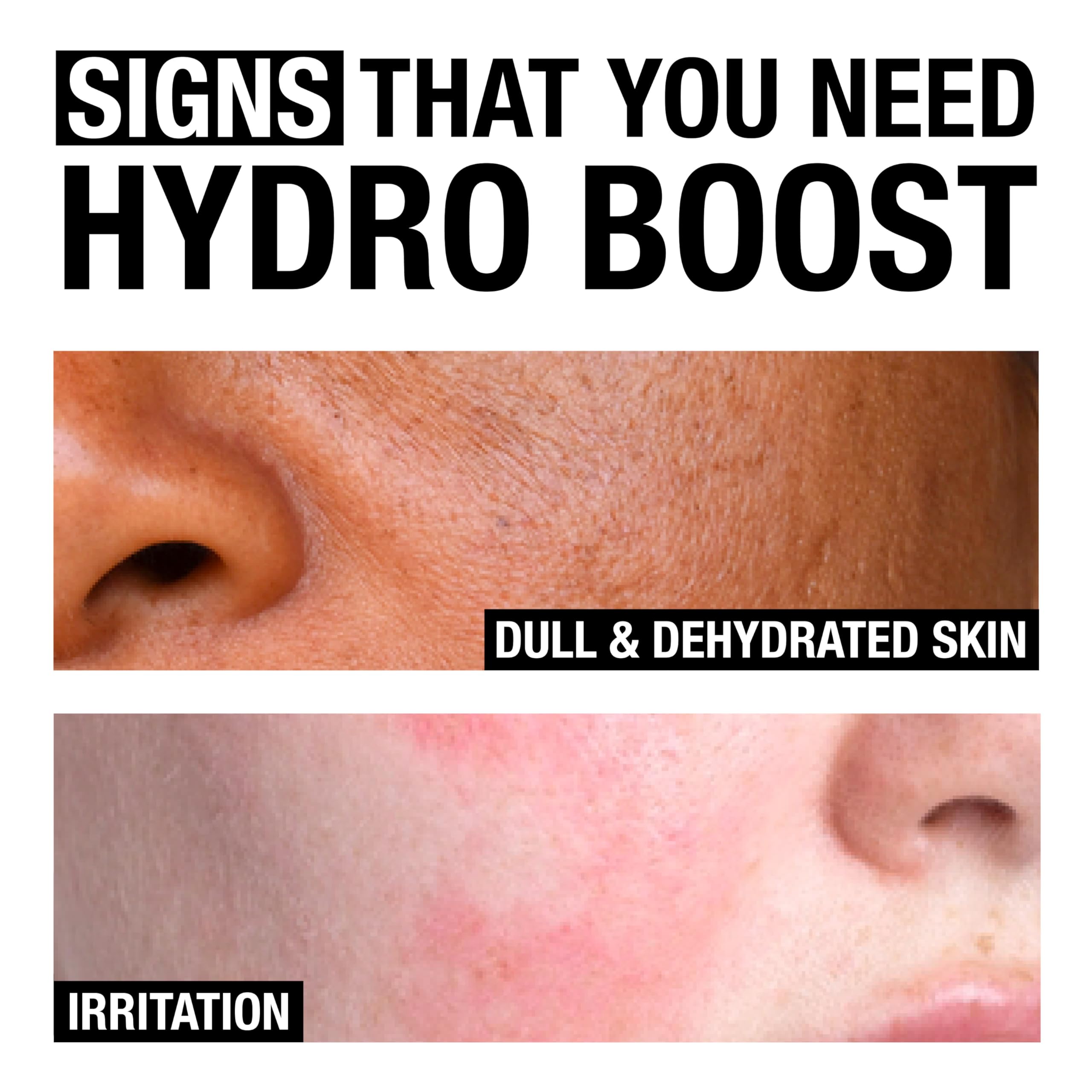 Foto 8 pulgar | Gel Limpiador Facial Neutrogena Hydro Boost 230 Ml Con Ácido Hialurónico - Venta Internacional.