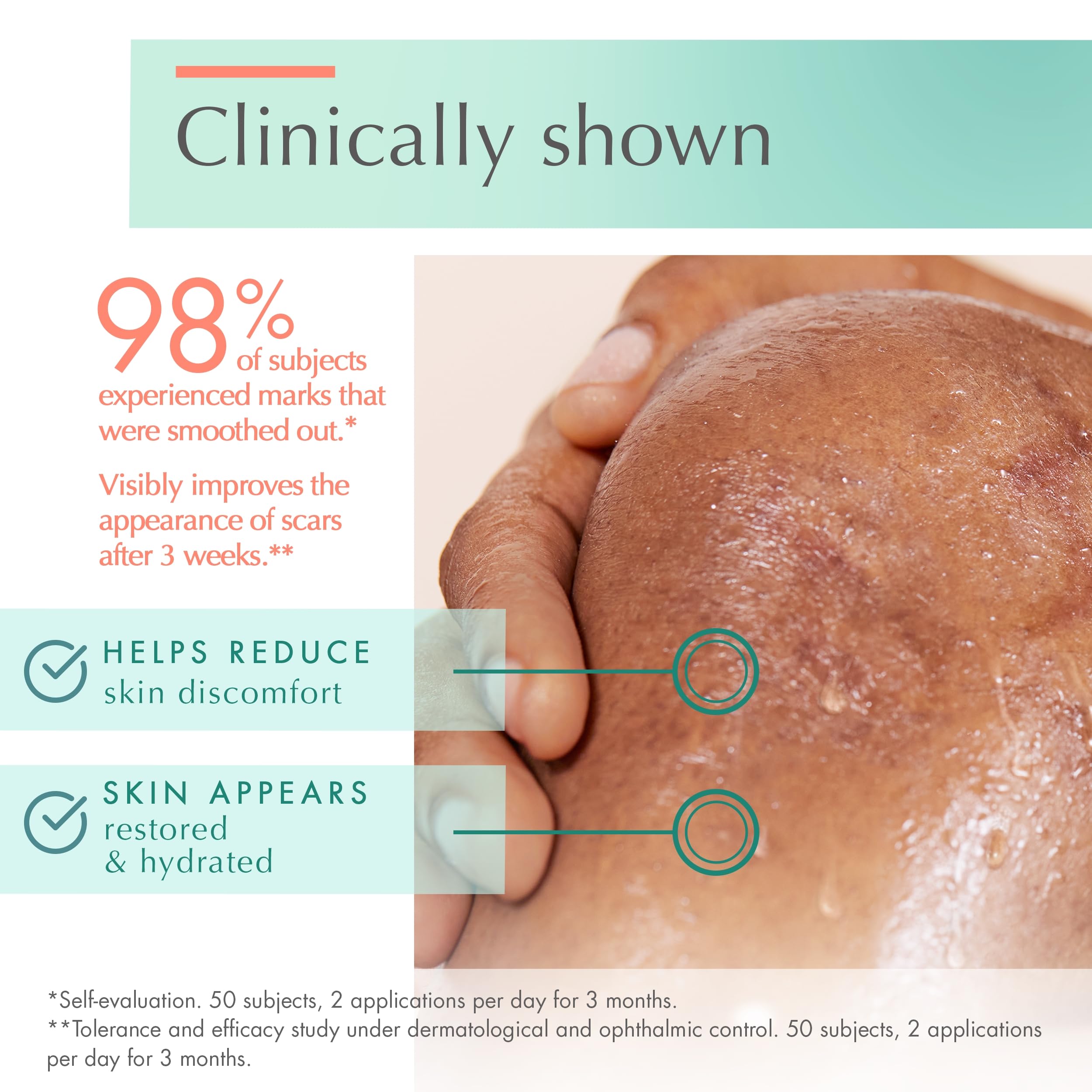 Foto 7 pulgar | Gel Para Cicatrices Eau Thermale Avène Cicalfate+ Para Cicatrices, 30 Ml - Venta Internacional.