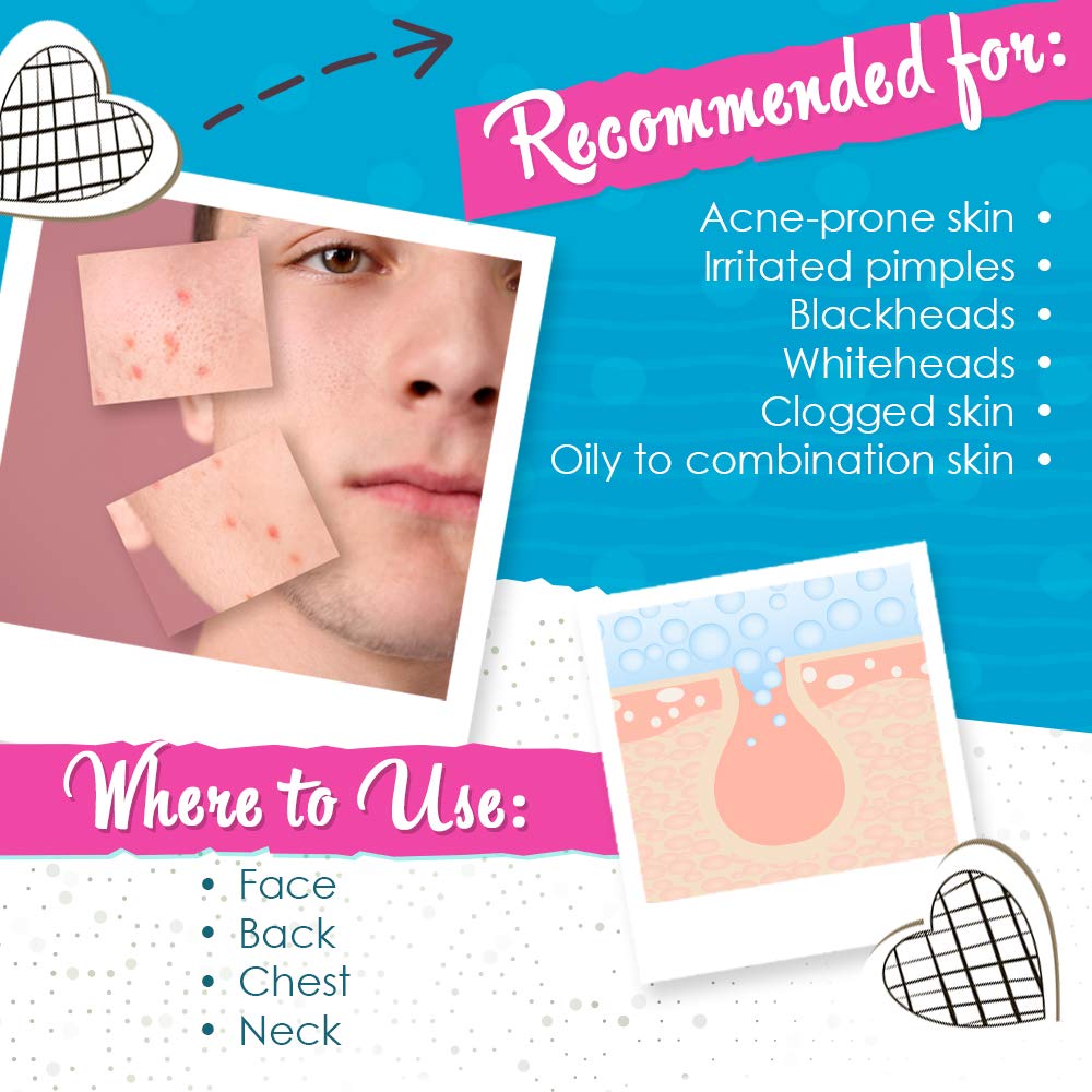 Foto 4 pulgar | Loción Secante Para El Acné Bye Bye Bye Blemish Reduce Las Espinillas, 30 Ml, Paquete De 2 - Venta Internacional.