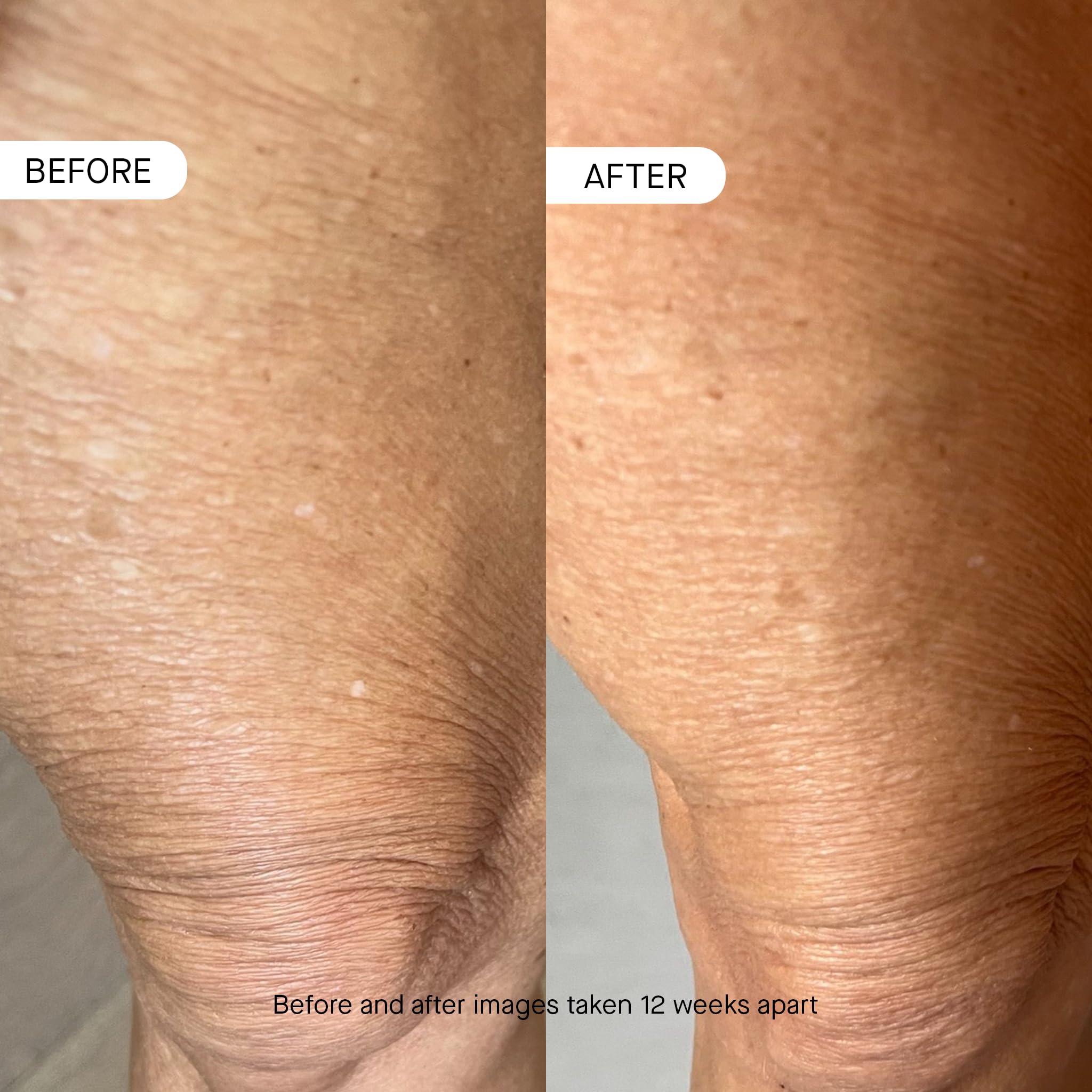 Foto 5 pulgar | Hidratante Oneskin Body Os-01 Peptide Skin Longevity - Venta Internacional