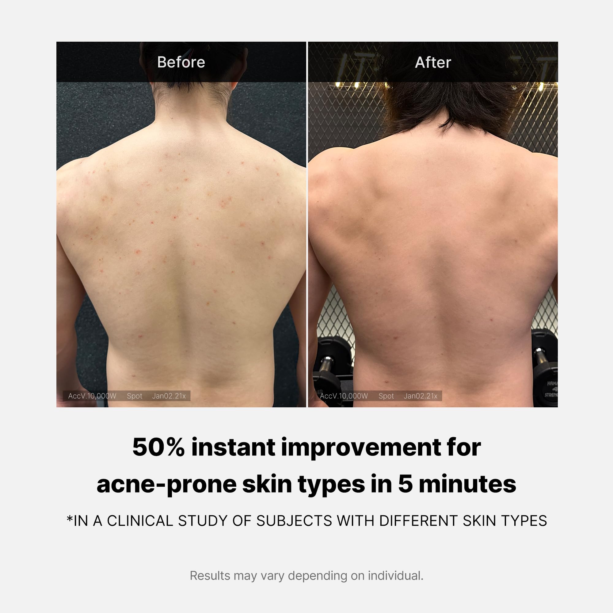 Foto 6 pulgar | Gel De Baño Medicube Red Acne Con Ácido Salicílico 430 Ml De Ph Bajo - Venta Internacional.