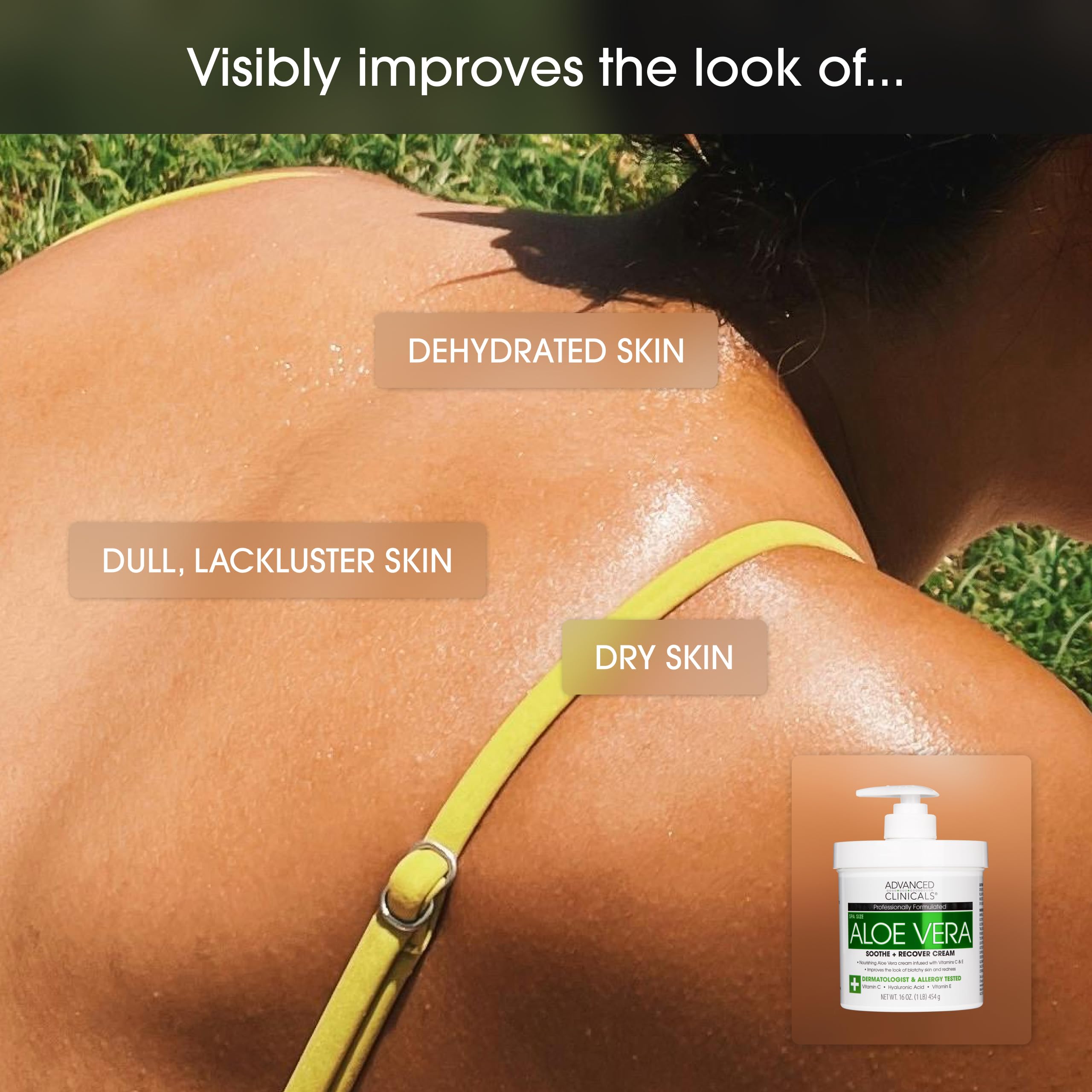 Foto 5 | Loción Corporal Advanced Clinicals Con Aloe Vera, 480 Ml, Sun Burn - Venta Internacional.