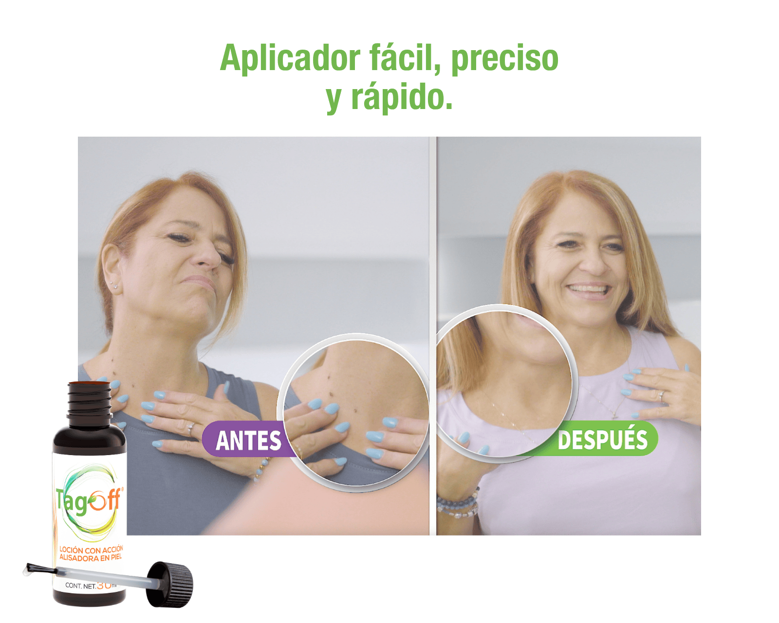 Foto 6 pulgar | Eliminador De Verrugas Con Brocha Tagoff  Jalea Real +thuja Occidental  Frasco Con 30 Ml  3 Pack.