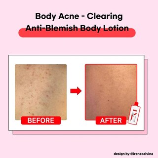 Foto 2 | Loción Corporal Tiam Antimanchas 200 Ml Con Aha Bha Y Niacinamida - Venta Internacional.