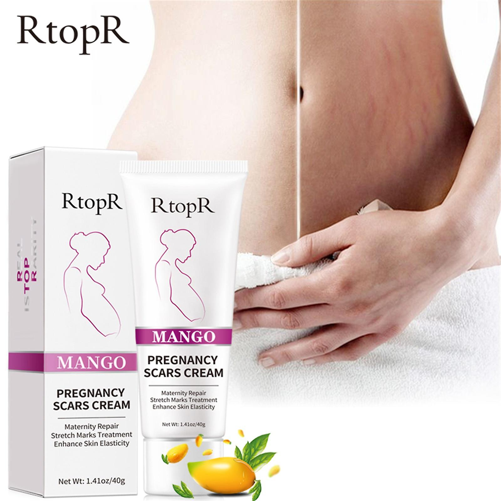 Foto 2 | Crema Para Eliminar Marcas De Acné  Estrías Gravidáricas  40 G - Venta Internacional.