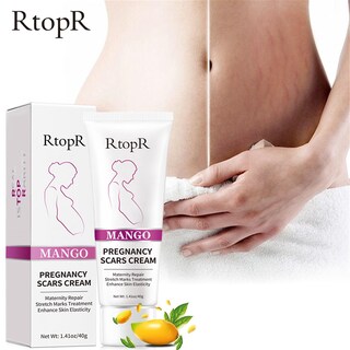Foto 2 | Crema Para Eliminar Marcas De Acné Estrías Gravidáricas 40 G - Venta Internacional.