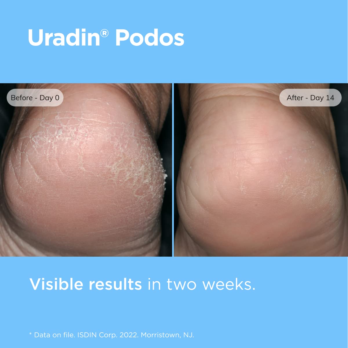 Foto 6 pulgar | Crema para Cuidado de Pies Isdin Uradin Podos en Gel 75 ml con 10% Urea - Venta Internacional