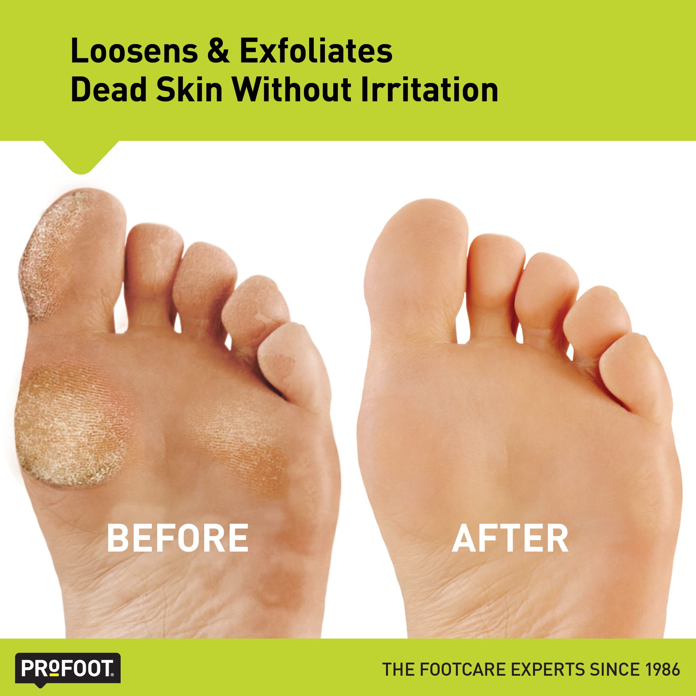 Foto 5 pulgar | Gel Exfoliante Profoot Heel Rescue Callus Blaster 90 Ml - Venta Internacional.