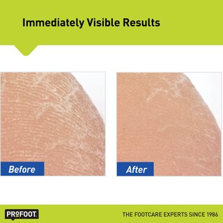 Foto 4 | Crema Para Pies Profoot Heel Rescue, 473 Ml, Paquete De 2 Unidades Para Piel Agrietada - Venta Internacional.