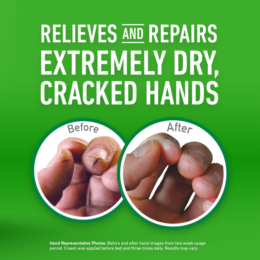 Foto 4 pulgar | Set De Cuidado De La Piel O'keeffe's Working Hands, Feet Repair & Lip Cream - Venta Internacional.