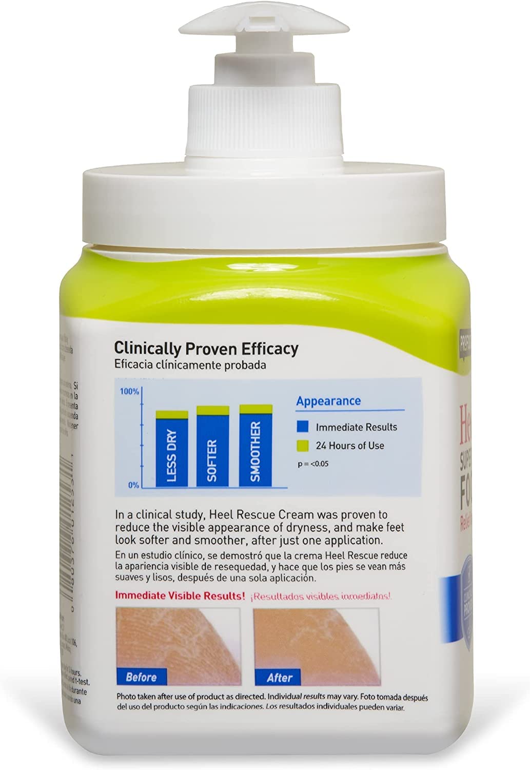 Foto 4 pulgar | Crema Para Pies Profoot Heel Rescue Superior Hidratante 480ml - Venta Internacional.