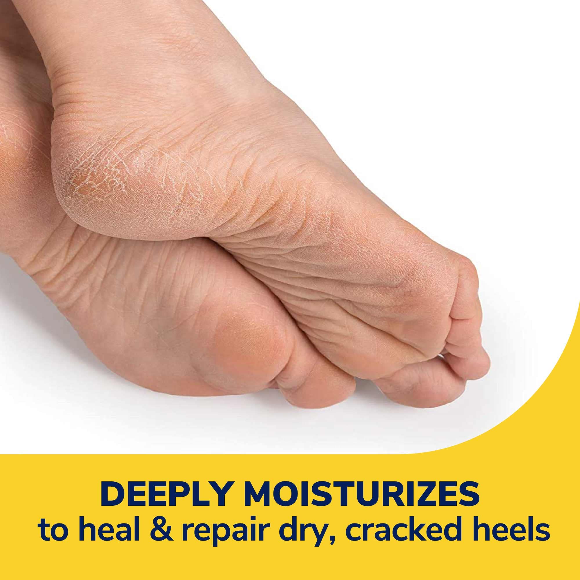 Foto 4 pulgar | Loción Dr. Scholl's Severe Cracked Heel Repair, 75 Ml, Con 25% De Urea - Venta Internacional.
