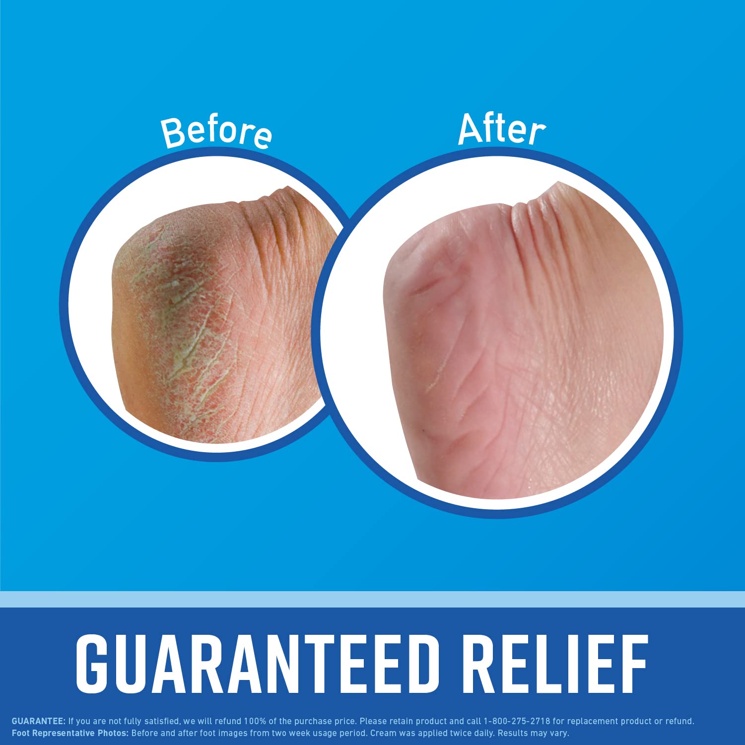 Foto 3 pulgar | Crema Para Pies O'keeffe's For Healthy Feet, 95 Ml (paquete De 3) - Venta Internacional.