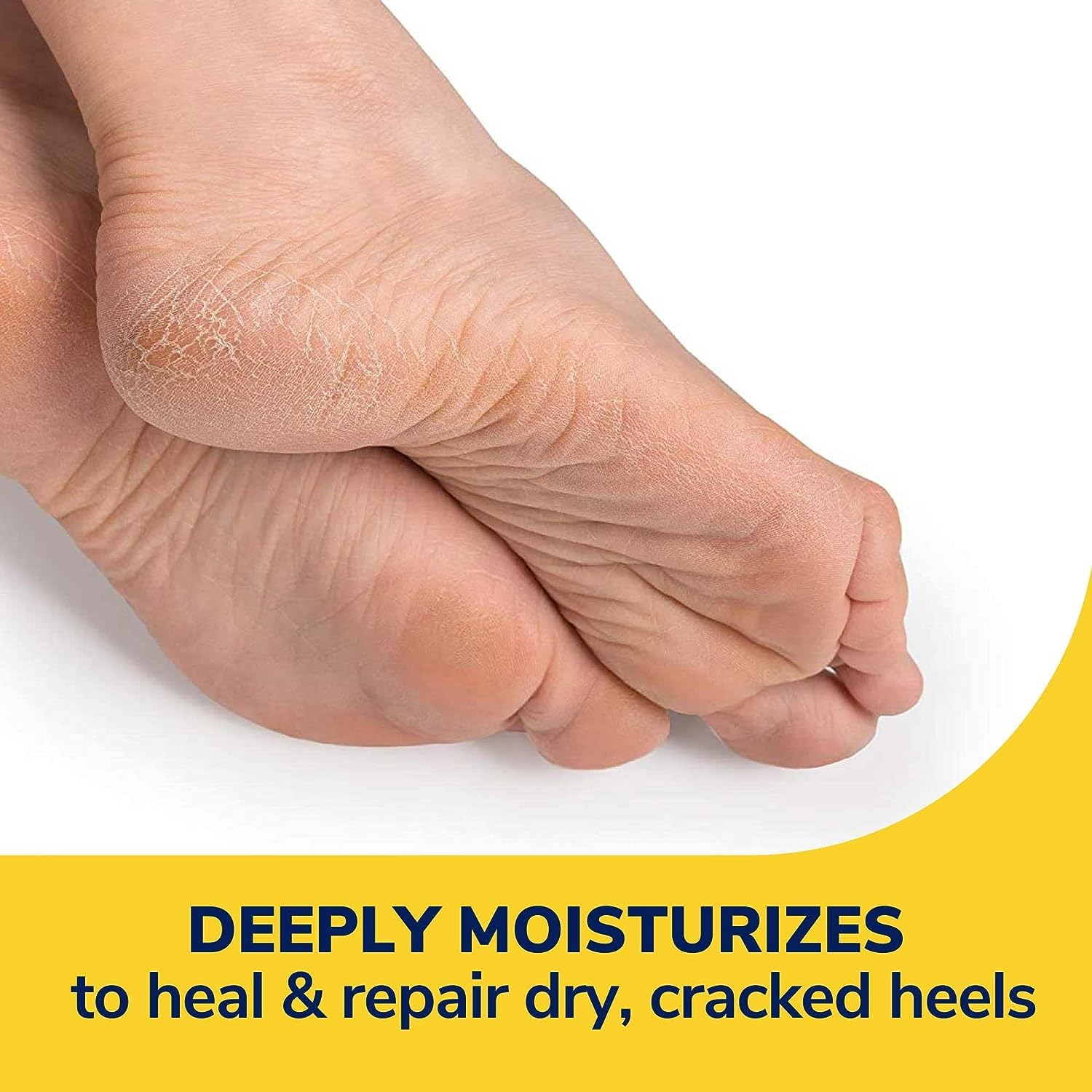 Foto 3 pulgar | Bálsamo Para Pies Dr. Scholl's Severe Cracked Heel Repair, 75 Ml, Paquete De 3 - Venta Internacional.