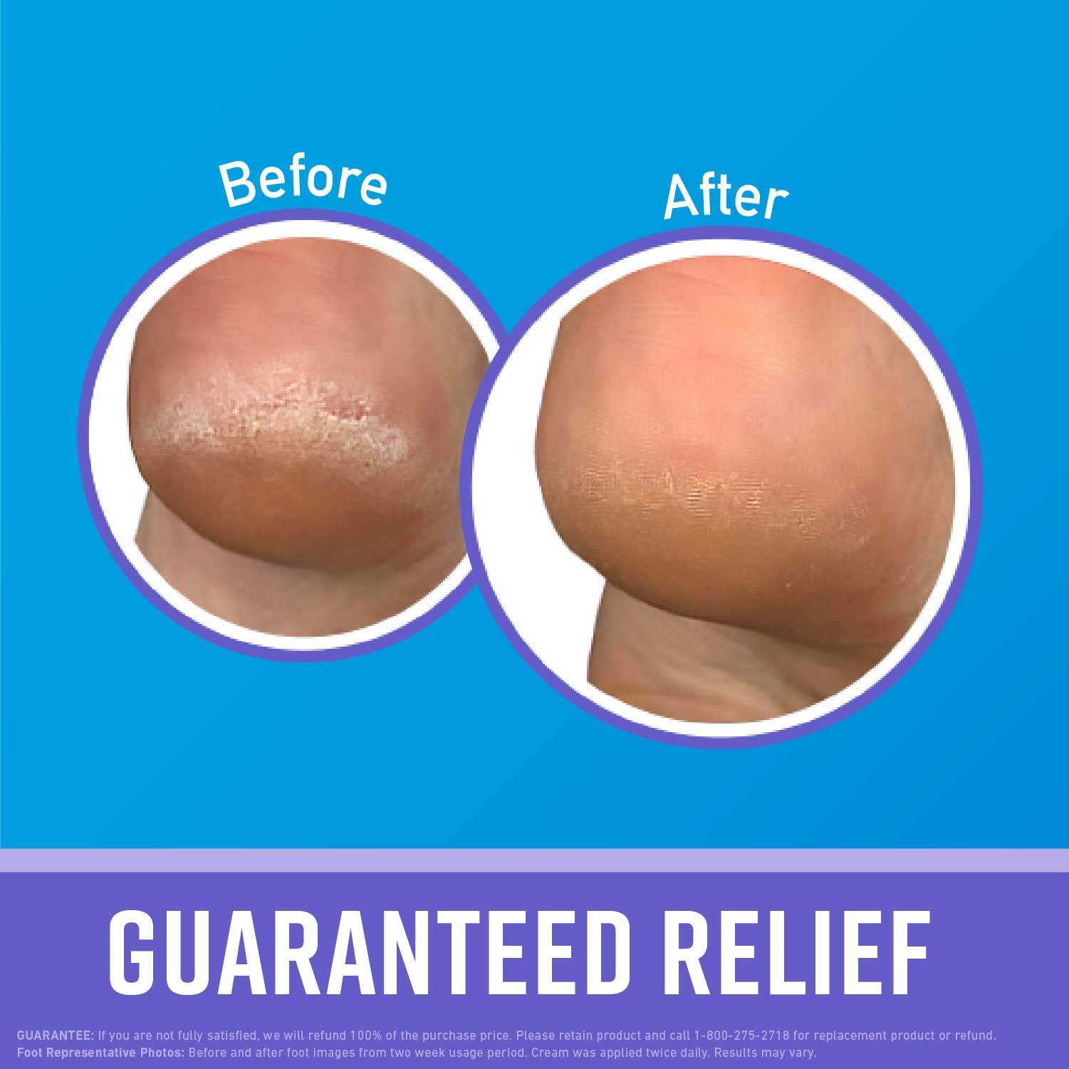 Foto 3 pulgar | Crema Para Pies De Tratamiento Nocturno O'keeffe's Healthy Feet 200 Ml X2 - Venta Internacional.