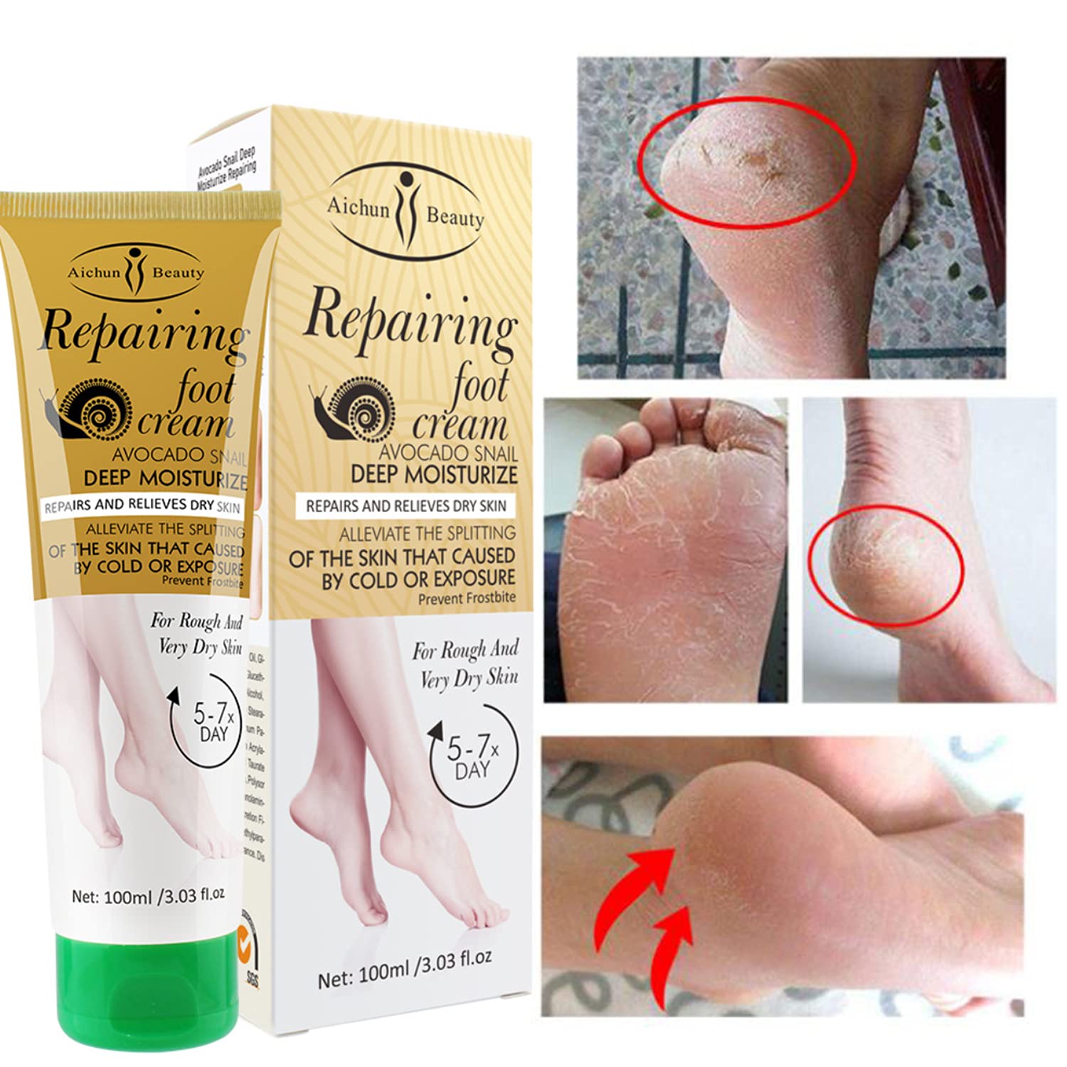 Foto 8 pulgar | Crema De Pies Aichun Beauty Reparadora Con Forma De Caracol De Aguacate, 100 Ml - Venta Internacional.