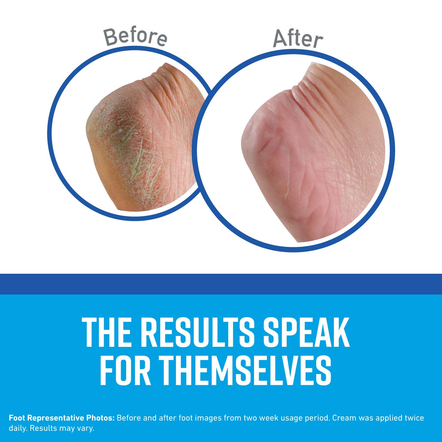 Foto 3 pulgar | Crema Para Pies O'keeffe's Healthy Feet 90 Ml (paquete De 3) - Venta Internacional.