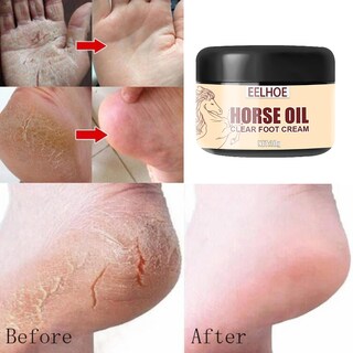 Foto 4 | Crema Para Pies Huoguo Aceite De Caballo Hidratante Anticongelante 10 G 50 G - Venta Internacional.