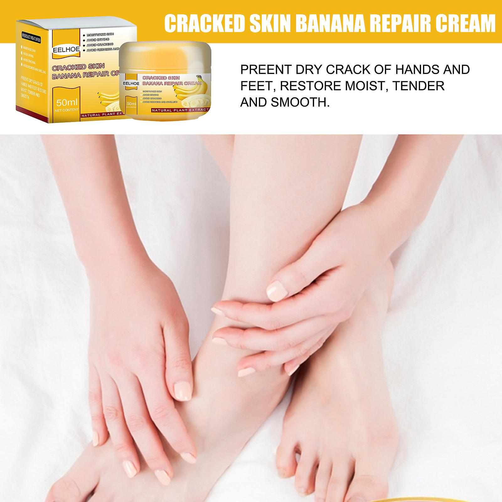 Foto 5 pulgar | Crema Bálsamo Para Talones Agrietados Huoguo Para Pies Ásperos  Secos Y Agrietados - Venta Internacional.