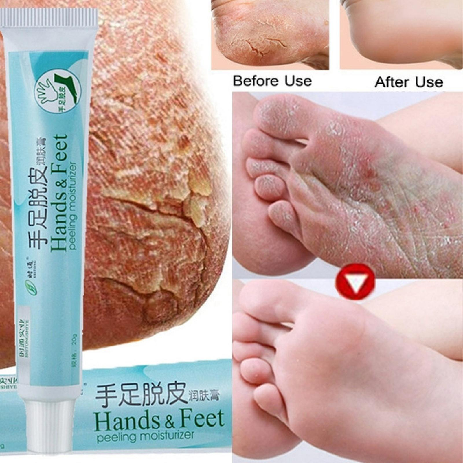 Foto 3 pulgar | Crema Bálsamo Para Talones Agrietados Huoguo Para Pies Ásperos  Secos Y Agrietados - Venta Internacional.