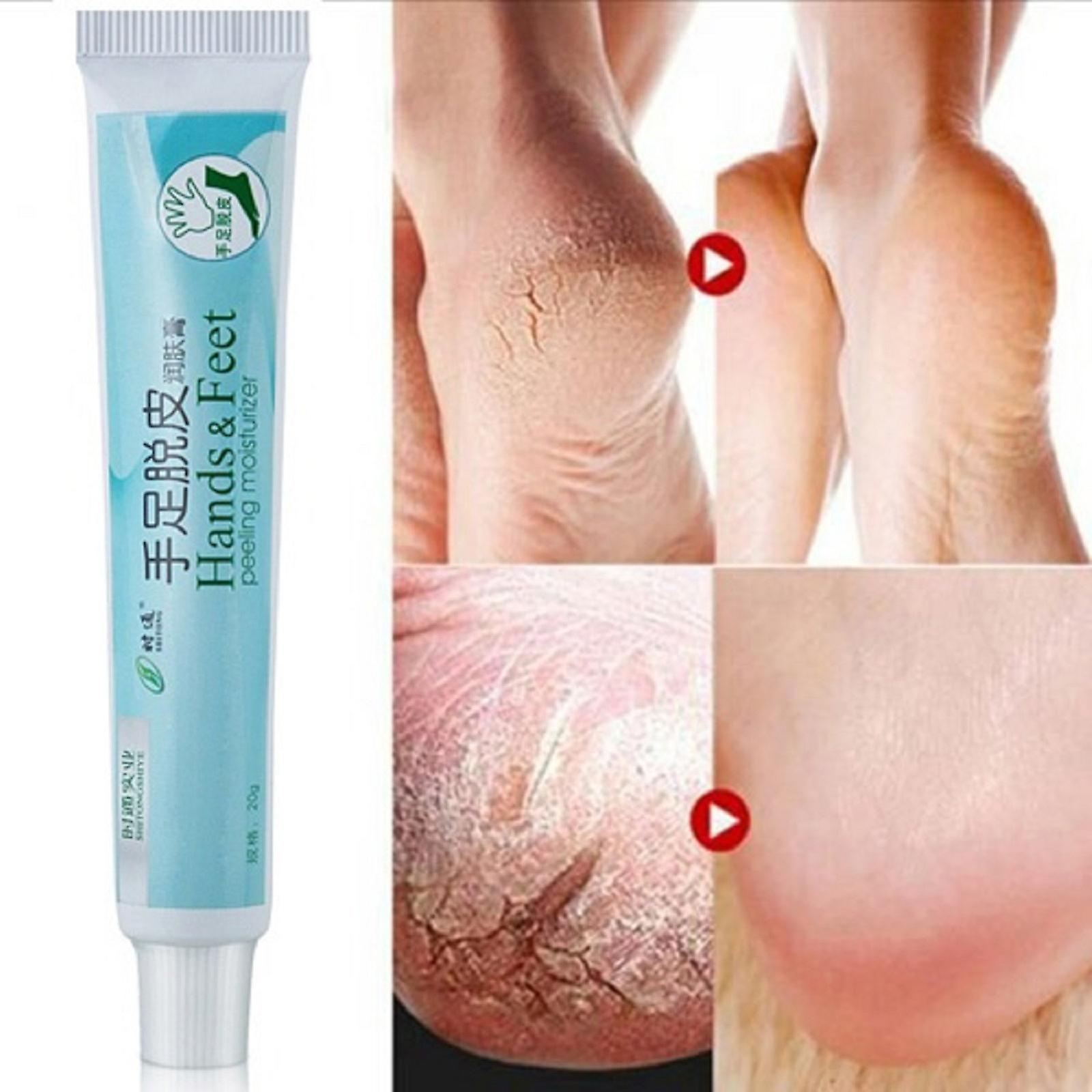 Foto 4 pulgar | Crema Bálsamo Para Talones Agrietados Huoguo Para Pies Ásperos  Secos Y Agrietados - Venta Internacional.