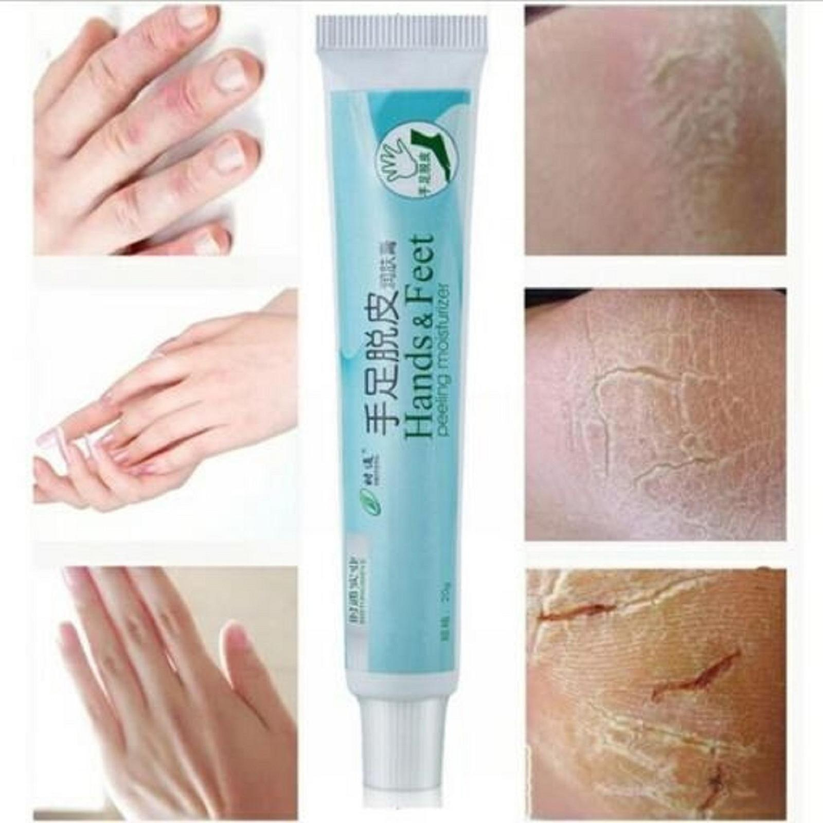 Foto 5 pulgar | Crema Bálsamo Para Talones Agrietados Huoguo Para Pies Ásperos  Secos Y Agrietados - Venta Internacional.