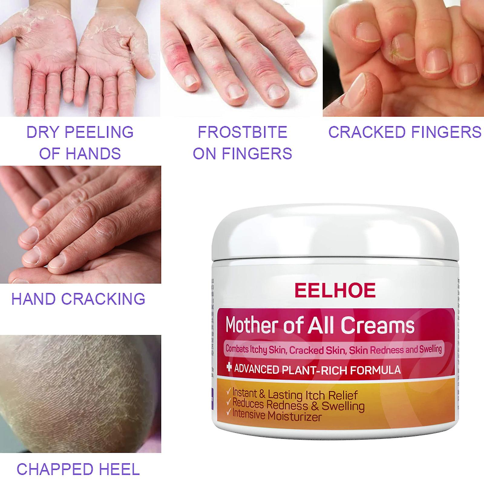 Foto 3 pulgar | Crema Huoguo Hidratante Antipicazón Para Pies Secos Y Agrietados - Venta Internacional.