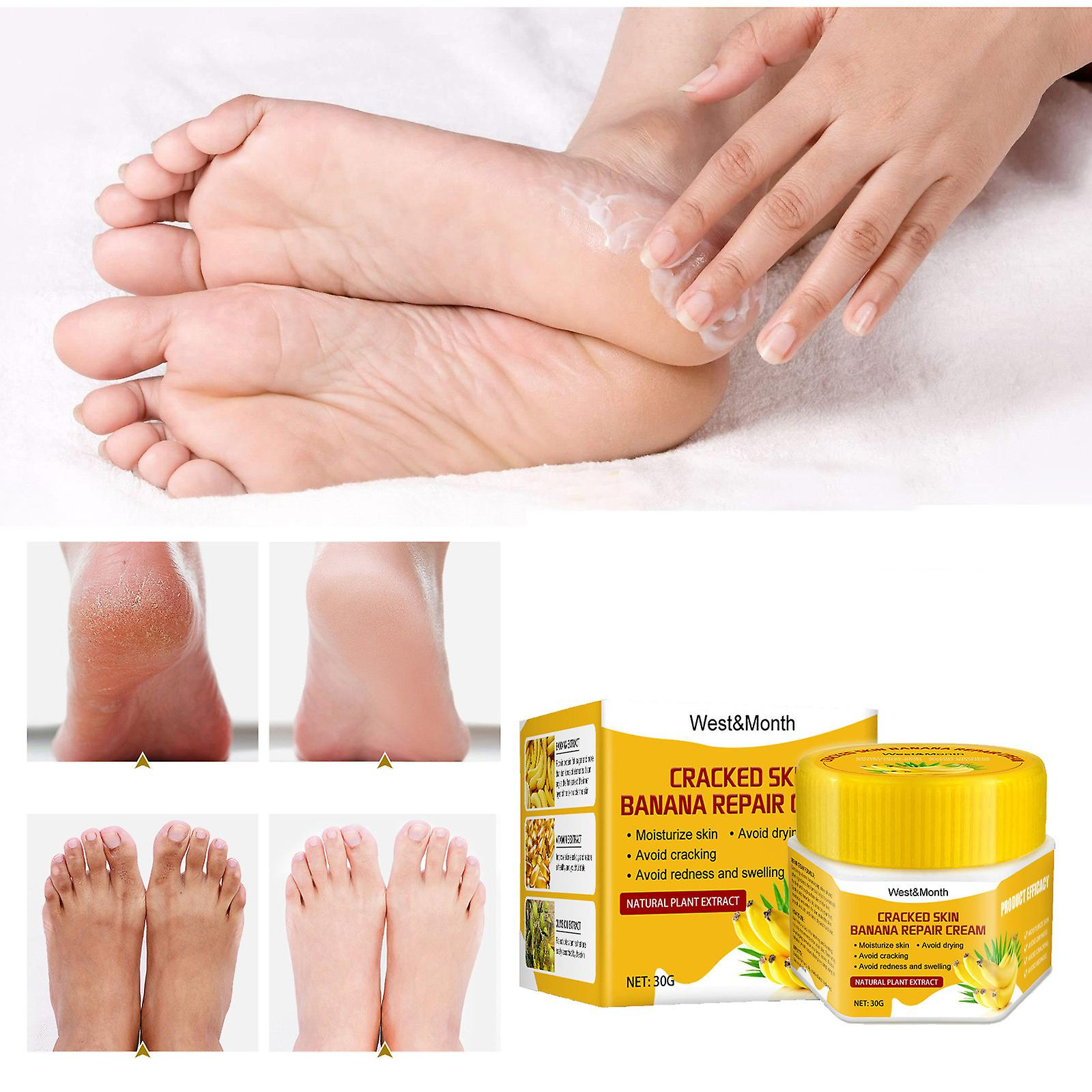 Foto 3 pulgar | Crema Bálsamo Para Talones Agrietados Huoguo Para Pies Ásperos  Secos Y Agrietados - Venta Internacional.