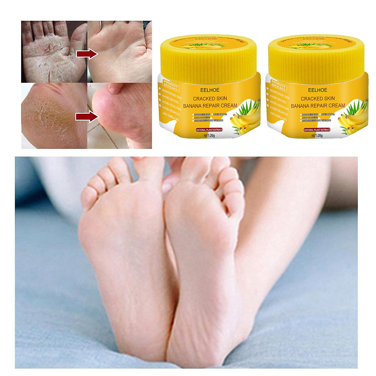 Foto 3 pulgar | Crema Bálsamo Para Talones Agrietados Huoguo Pies Ásperos  Secos Y Agrietados - Venta Internacional.