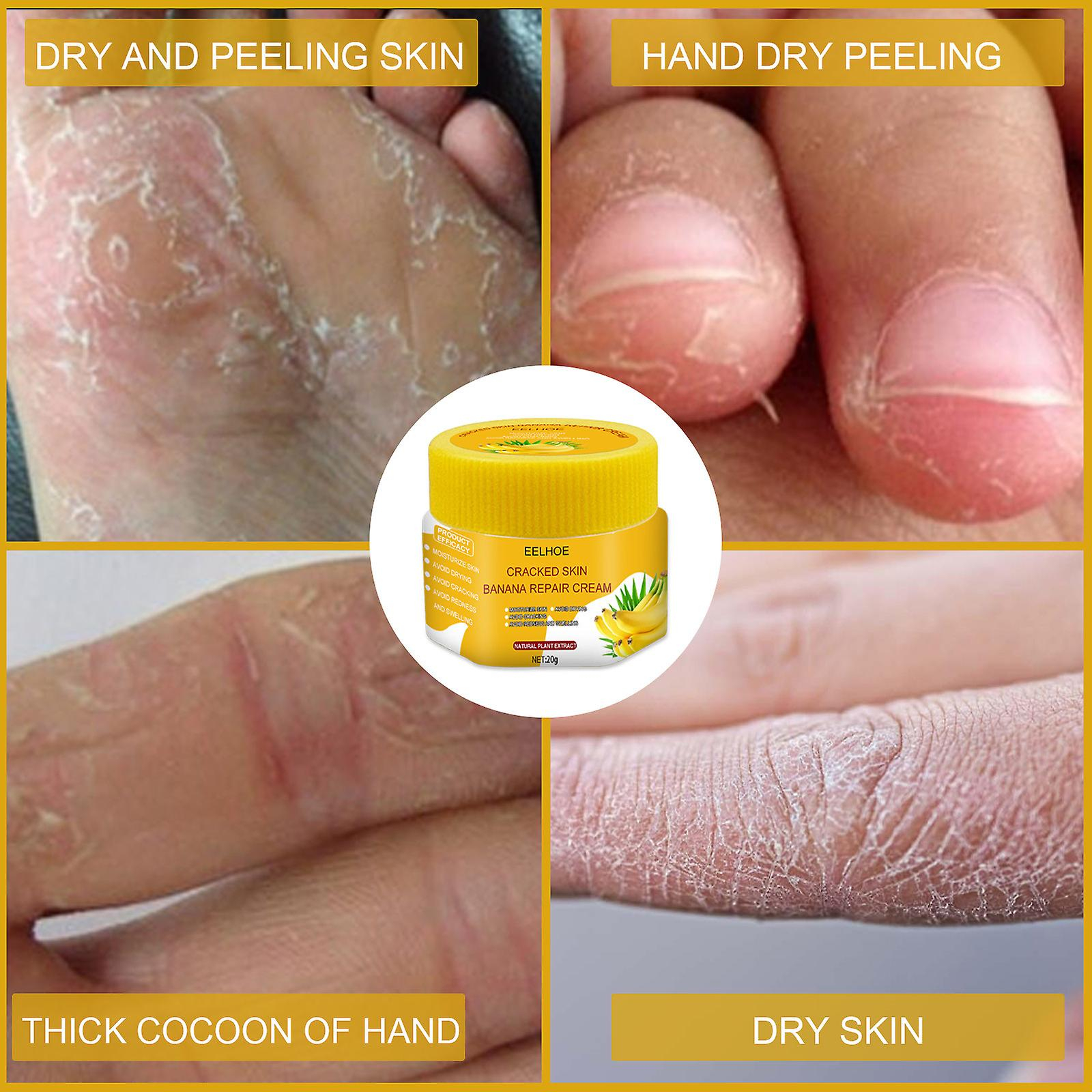 Foto 5 pulgar | Crema Bálsamo Para Talones Agrietados Huoguo Para Pies Ásperos  Secos Y Agrietados - Venta Internacional.