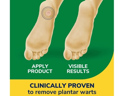 Foto 7 | Eliminador De Verrugas Dr. Scholl's Clear Away Plantar 24 Unidades (paquete De 2) - Venta Internacional.