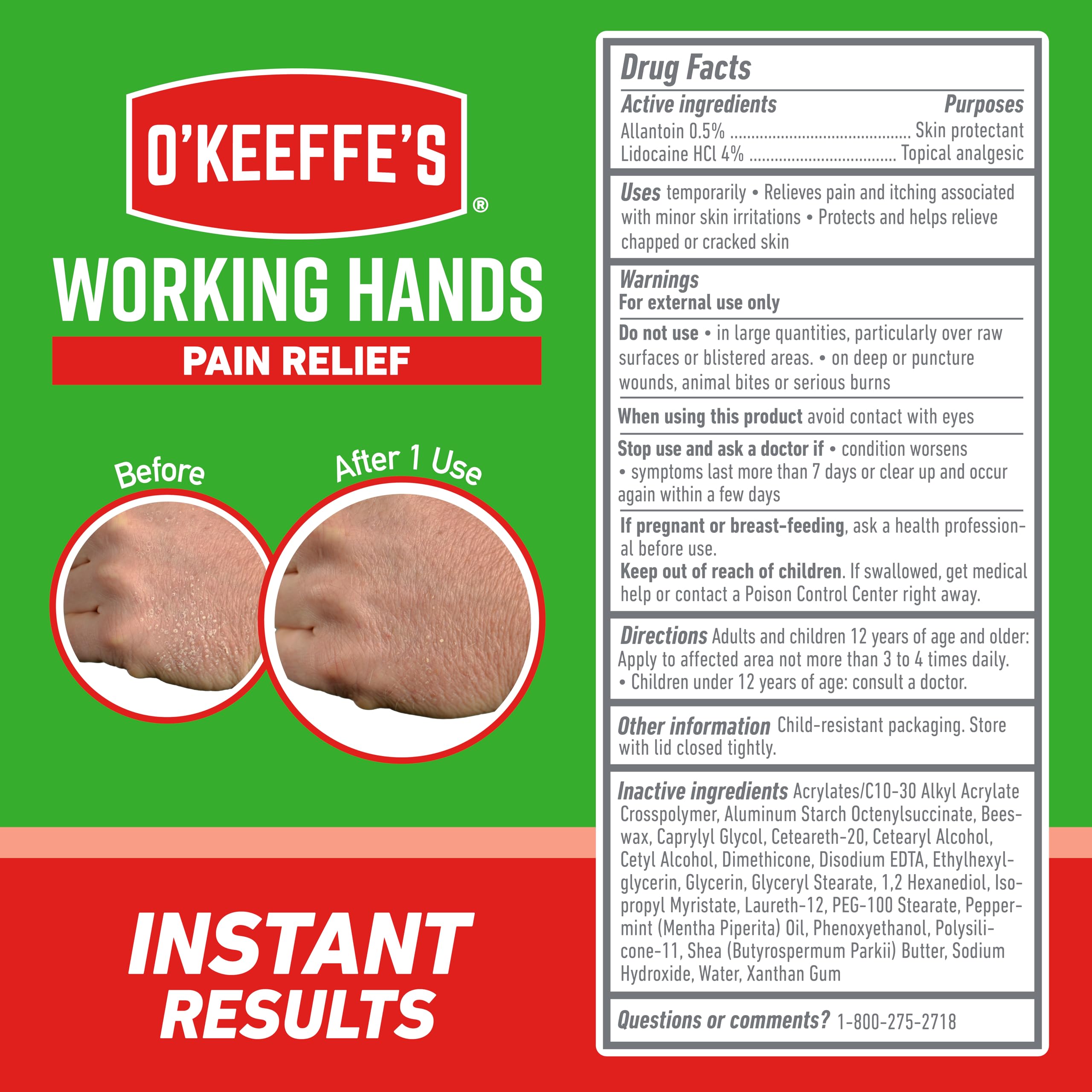 Foto 6 pulgar | Crema O'keeffe's Working Hands Para Aliviar El Dolor Con Lidocaína Al 4%, 90 Ml - Venta Internacional.