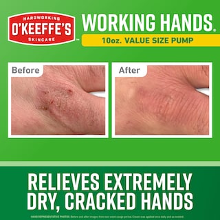 Foto 2 | Crema De Manos O'keeffe's Working Hands Frasco Dosificador De 300 Ml Extreme Dry - Venta Internacional.